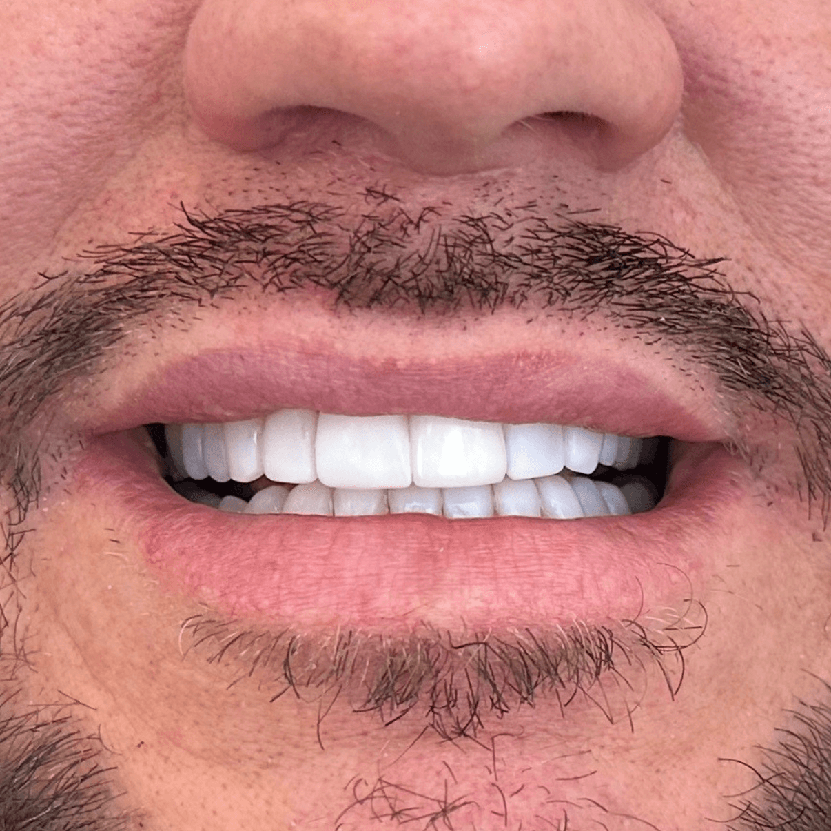 Case 1 after