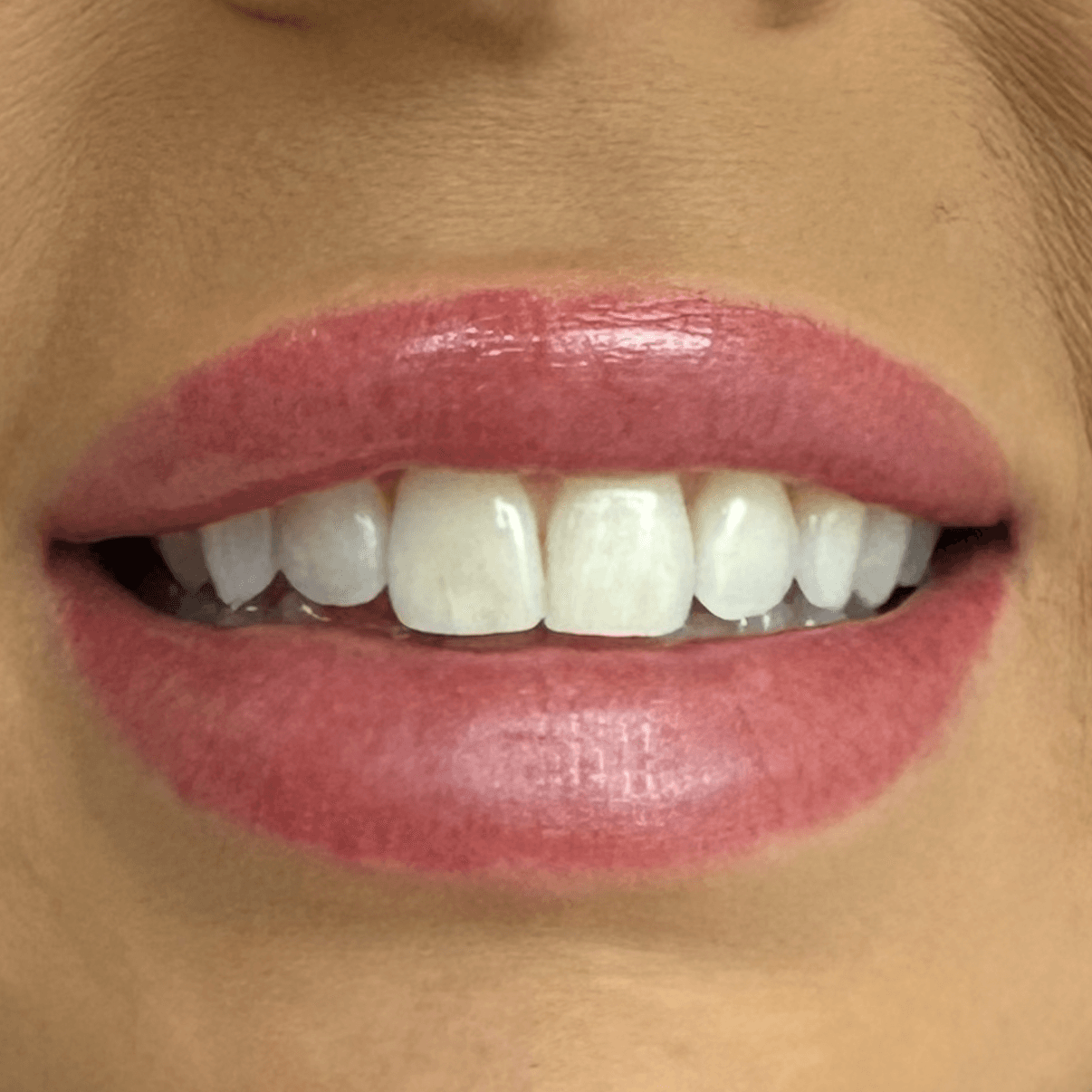 Case 2 before